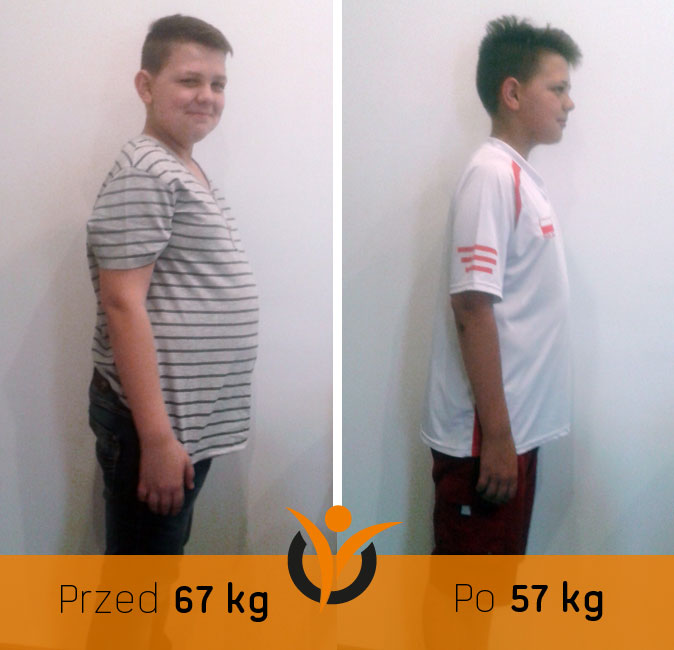 Najmłodszy podopieczny Poradni - Patryk (12lat), który <strong>stracił 10kg, </strong>dzięki zmianie nawyków żywieniowych.